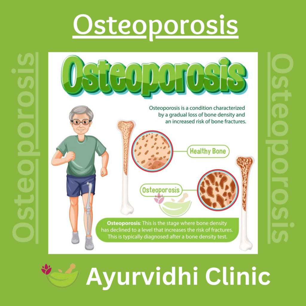Strong from Within: Ayurvedic Management of Osteoporosis