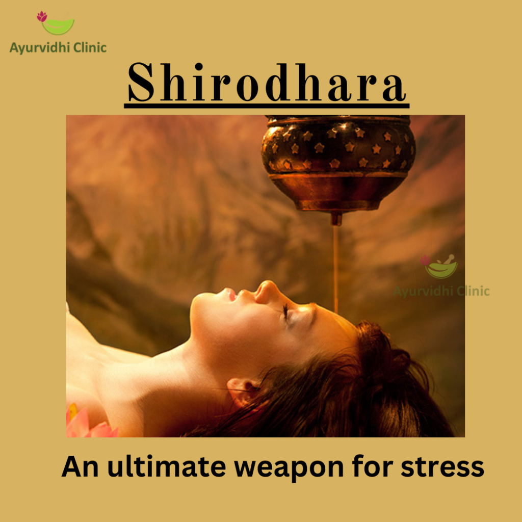 Shirodhara: An ultimate weapon for stress in todays era